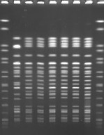 パルスフィールド電気泳動像