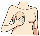 人工乳房（加工）