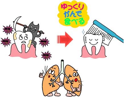 口腔ケアで誤嚥性肺炎予防のイラスト