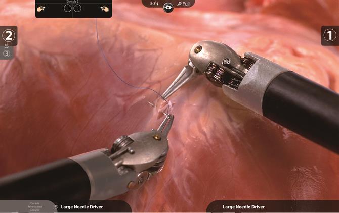 Img001_Si_Surgeon_Console_Controls_and_Operative_Field_View_183935-1