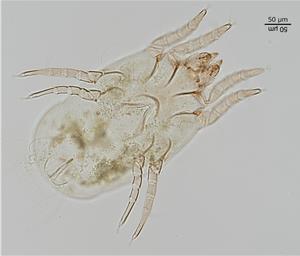 ヤケヒョウヒダニ（めす）